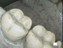 Load image into Gallery viewer, Acteon SoPro Life Dental Intraoral Camera Imaging System