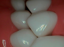 Load image into Gallery viewer, Digi Doc (Digital Doc) Iris (USB 2.0) Dental Intraoral Camera Imaging System