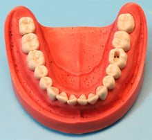 Load image into Gallery viewer, Heine Double Binocular Dental Loupe Kit