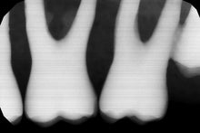 Load image into Gallery viewer, Gendex GXS-700 Dental Intraoral X-Ray Sensor Size 1