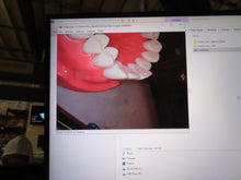 Load image into Gallery viewer, Digi Doc (Digital Doc) Iris (USB 2.0) Dental Intraoral Camera Imaging System