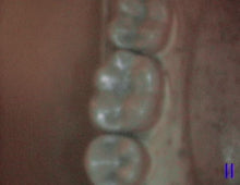 Load image into Gallery viewer, Acteon SoPro Life Dental Intraoral Camera Imaging System (2016)