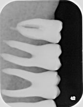 Load image into Gallery viewer, Air Techniques ScanX Swift Digital Imaging System Dental Phosphor Scanner