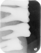 Load image into Gallery viewer, Air Techniques ScanX Classic Dental Phosphor Plate Scanner Year: 2019