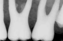 Load image into Gallery viewer, Schick 33 Dental Intraoral X-Ray Sensor w/ Docking Station (Remote Interface) Size 1