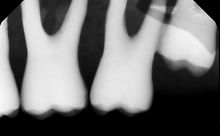 Load image into Gallery viewer, Gendex GXS-700 Dental Intraoral X-Ray Sensor Size 2 - FOR PARTS/REPAIR