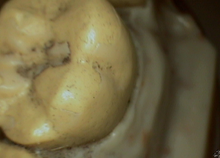 Load image into Gallery viewer, DigitalDOC Iris Dental Intraoral Camera Imaging Unit