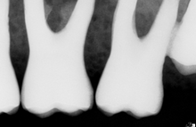 Load image into Gallery viewer, Schick CDR Elite Dental Imaging Sensor Size 1