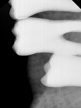 Load image into Gallery viewer, VaTech EZ HD 1.5 Dental Intraoral X-Ray Sensor - FOR PARTS/REPAIR