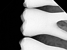 Load image into Gallery viewer, Acteon SoPix X-ray Sensor Model 2 Size 2

