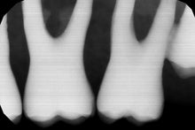 Load image into Gallery viewer, Gendex GXS-700 Dental Digital Intraoral X-Ray Sensor Size 1
