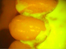 Load image into Gallery viewer, Air Techniques Cam-X Spectra Dental Intraoral Camera Imaging System
