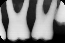 Load image into Gallery viewer, Gendex GXS-700 Dental Digital Intraoral X-Ray Sensor Size 1
