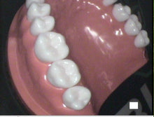 Load image into Gallery viewer, Acteon SoPro Care Dental Intraoral Camera Imaging System
