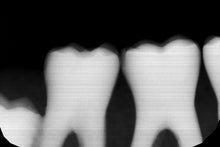 Load image into Gallery viewer, Gendex GXS-700 Dental Intraoral X-Ray Sensor Size 2 SOLD AS IS
