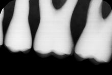 Load image into Gallery viewer, Gendex GXS-700 Dental Intraoral X-Ray Sensor Size 1
