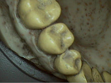 Load image into Gallery viewer, DigitalDOC Iris Dental Intraoral Camera Imaging System
