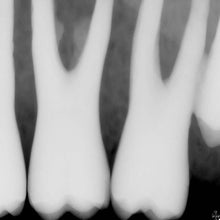 Load image into Gallery viewer, Schick 33 Dental Intraoral X-Ray Sensor w/ Docking Station Size 1
