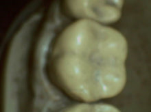 Load image into Gallery viewer, DigitalDOC Iris Dental Intraoral Camera Imaging System
