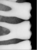 Load image into Gallery viewer, Kodak RVG 6100 Dental Intraoral X-Ray Sensor Size 1
