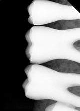 Load image into Gallery viewer, Vatech EzSensor HD 1.5 Dental X-Ray Sensor USB
