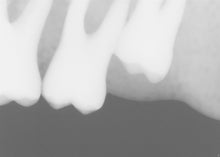 Load image into Gallery viewer, Sirona Schick 33 Dental Intraoral X-Ray Sensory Size 1

