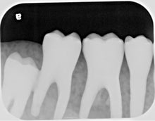 Load image into Gallery viewer, Air Techniques Scan X 2 IO Dental X-Ray Phosphor Plate Scanner
