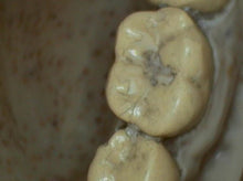 Load image into Gallery viewer, DigitalDOC Iris Dental Intraoral Camera Imaging System
