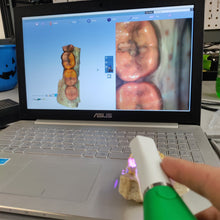 Load image into Gallery viewer, Planmeca Emerald Intraoral Scanner Dental Digital Impression Wand Romexis
