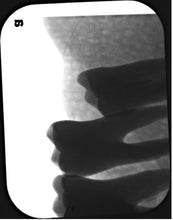 Load image into Gallery viewer, Air Techniques ScanX 2 IO Dental Phosphor Plate X-Ray Scanner
