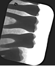 Load image into Gallery viewer, Air Techniques ScanX 2 IO Dental Phosphor Plate X-Ray Scanner

