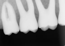 Load image into Gallery viewer, Sirona XIOS XG USB Interface Module Schick Dental Digital X-Ray Sensor Box
