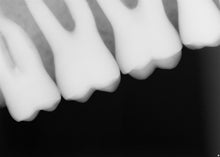 Load image into Gallery viewer, Schick Sirona CDR Elite USB Remote Module Dental Digital X-Ray Sensor Interface
