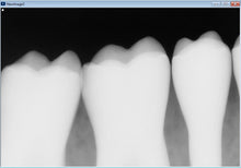 Load image into Gallery viewer, Sirona Schick 33 Dental Intraoral X-Ray Sensor Size 1
