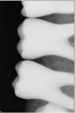 Load image into Gallery viewer, Sirona Schick 33 Size 1 Digital Dental Intraoral X-Ray Sensor

