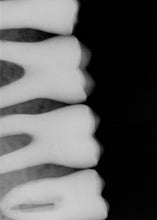 Load image into Gallery viewer, Dentsply Sirona Schick CDR Elite Intraoral Dental X-Ray Sensor Size 1- No Software
