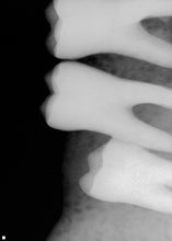 Load image into Gallery viewer, Dentsply Sirona Schick CDR Elite Intraoral Dental X-Ray Sensor Size 1- No Software
