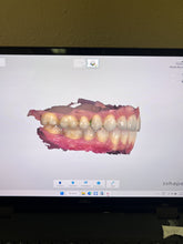 Load image into Gallery viewer, 3Shape Trios 5 Wireless Intraoral Dental Scanner w/ Laptop for CAD CAM

