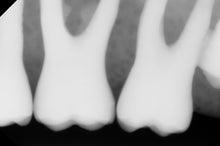 Load image into Gallery viewer, Apex Tuxedo Dental Imaging Sensor Size 1
