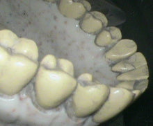 Load image into Gallery viewer, Acteon SoPro Life Dental Intraoral Camera Imaging System (2019)
