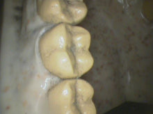 Load image into Gallery viewer, Air Techniques CamX Elara Dental High-Resolution Intraoral Camera
