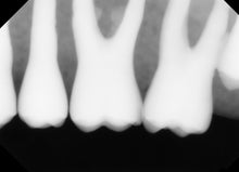 Load image into Gallery viewer, Apex Tuxedo Dental Imaging Sensor Size 2
