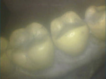 Load image into Gallery viewer, ProDent PD-740 Dental Intraoral Camera Intra Oral Imaging Unit - SOLD AS-IS
