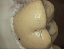Load image into Gallery viewer, DigitalDOC Iris Dental Intraoral Camera Imaging Unit
