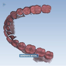 Load image into Gallery viewer, Planmeca Emerald Dental Intraoral Scanner for CAD/CAM Restorative Dentistry
