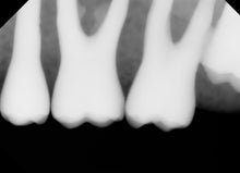 Load image into Gallery viewer, Apex Tuxedo Dental Imaging Sensor Size 2
