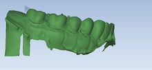 Load image into Gallery viewer, Planmeca Emerald Dental Intraoral Scanner for CAD/CAM Dentistry
