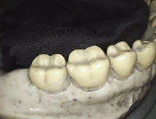 Load image into Gallery viewer, Carestream CS1500 Wireless Dental Intraoral Camera Imaging System
