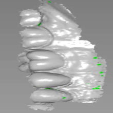 Load image into Gallery viewer, Carestream CS 3600 Dental Intraoral Scanner for CAD/CAM Restorative Dentistry
