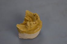 Load image into Gallery viewer, Hanau Ulti-Mate Dental Lab Articulator Occlusal Plane Analyzer
